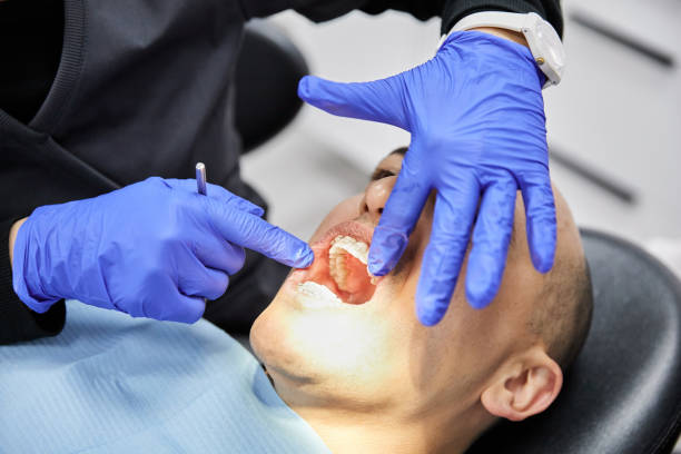 Best Emergency Wisdom Teeth Removal in Kingsford, MI